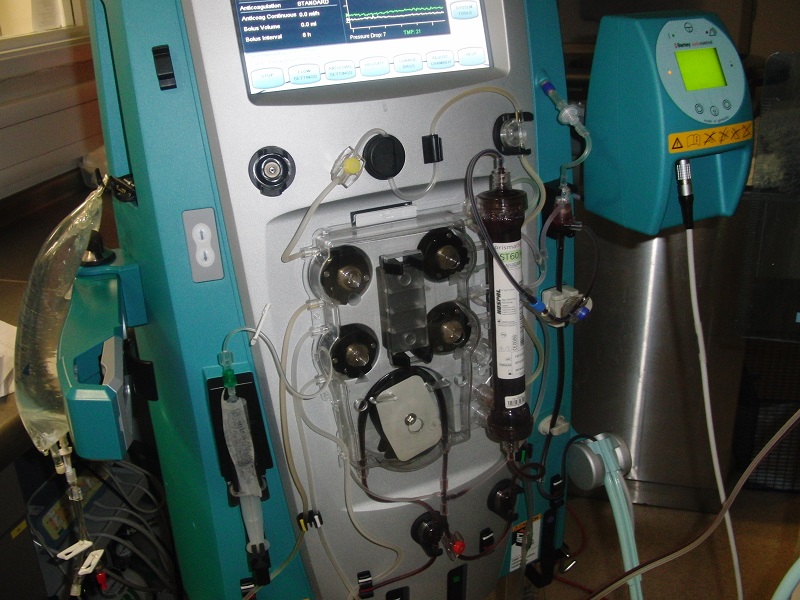 How Much Does A Home Dialysis Machine Cost Uk Review Home Co